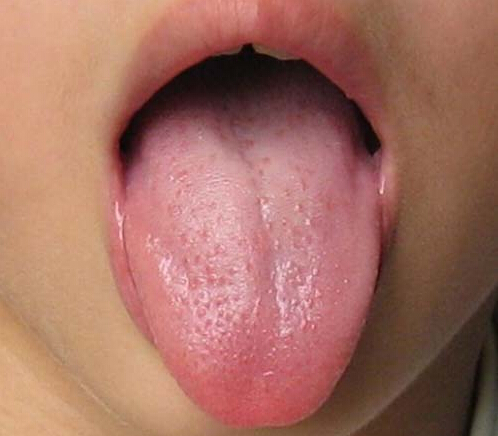 中医解析如何通过舌苔看健康 中医解析如何通过舌苔看健康状态