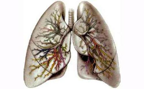 慢阻肺饮食要注意什么 慢阻肺的饮食疗法