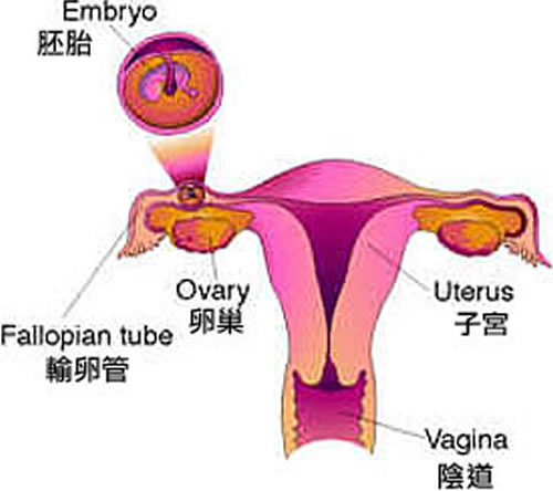 什么是宫外孕 什么是宫外孕是由什么原因引起的