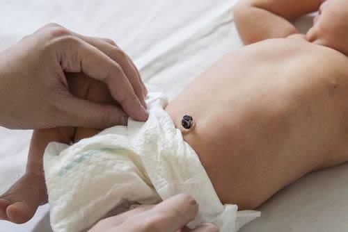 新生儿脐带脱落后怎么护理 新生儿脐带脱落后怎么护理还有点胎毒