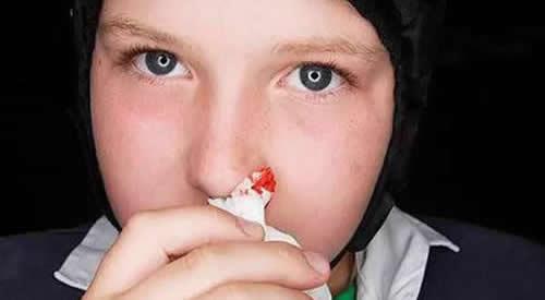 小孩冬天流鼻血是什么原因（冬天孩子流鼻血是什么原因引起的）
