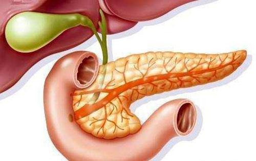 怎么会得急性胰腺炎 怎么会得急性胰腺炎 胆结石