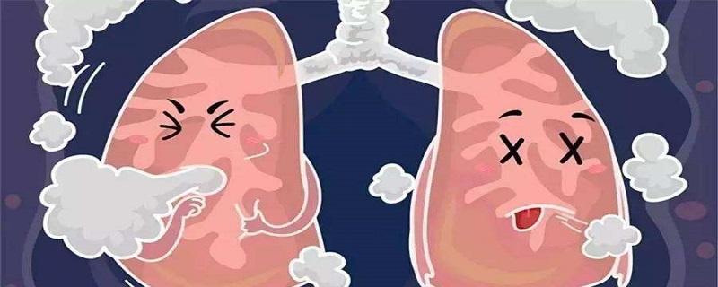 肺癌的早期信号有哪些 肺癌症的早期信号有哪些