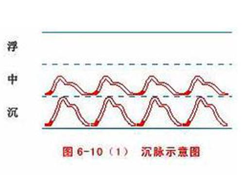 脉象沉是什么意思（中医说脉象沉是什么意思）