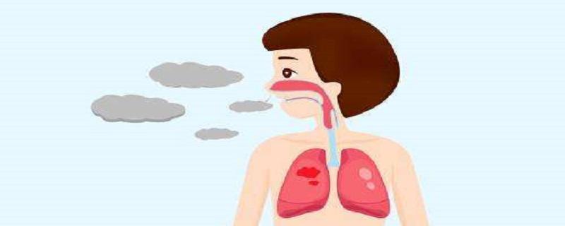 支气管炎属什么科室 支气管炎症挂哪个科