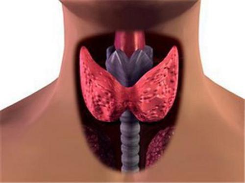 甲状腺结节有什么影响 抽烟对甲状腺结节有什么影响