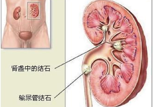 肚子胀尿少怎么回事（尿少小肚子胀是怎么回事）