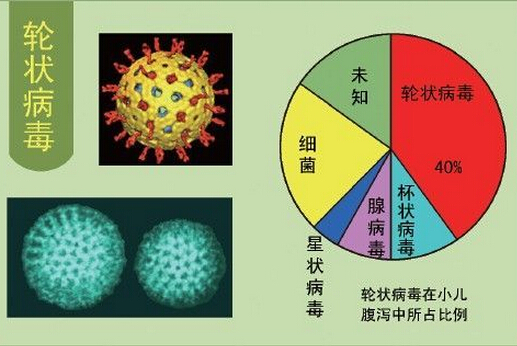 轮状病毒性腹泻治疗 轮状病毒腹泻治疗原则