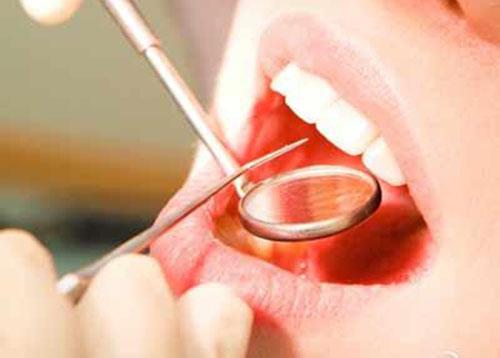 口腔溃疡怎么引起的 口腔溃疡是什么原因