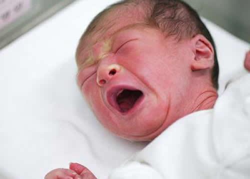 黄疸高对婴儿有什么影响 新生儿黄疸高有什么影响