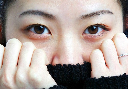 6种眼部异常状况对身体健康的暗示 身体出现问题显示眼部