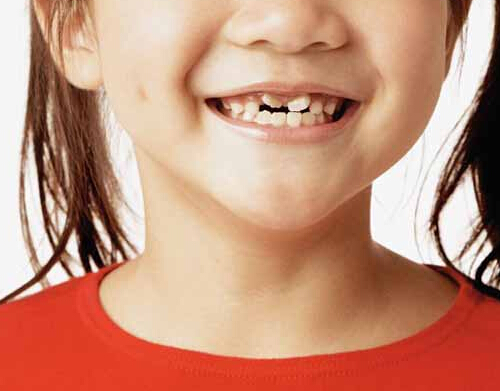 儿童换牙期间吃什么好 儿童换牙期间吃什么好呢