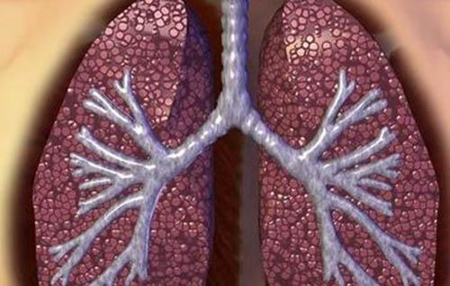 肺气肿是怎么引起的 肺气肿的原因