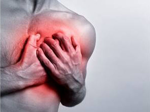 急性心梗的临床表现 急性心梗的临床表现及急救措施