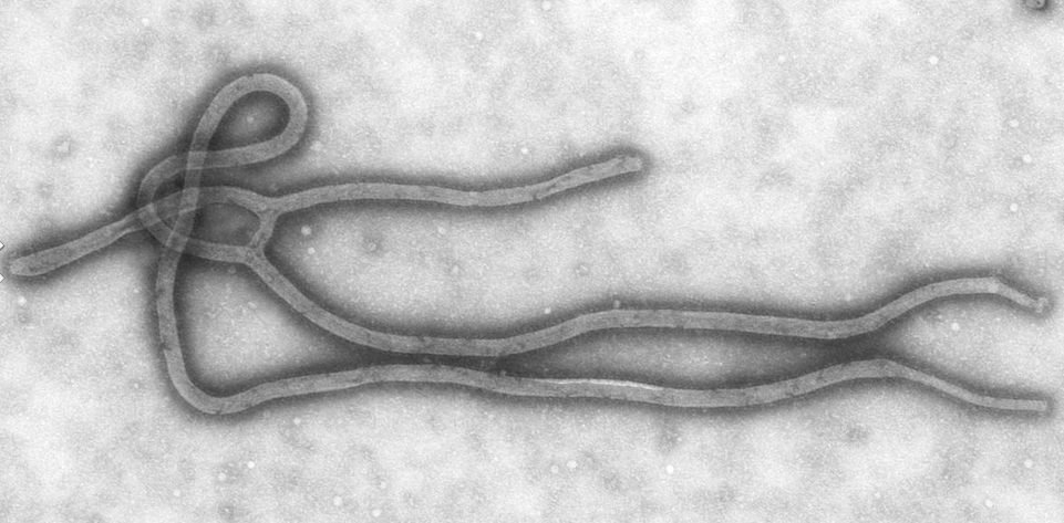 埃博拉病毒到底为何物，是否会威胁中国安全？