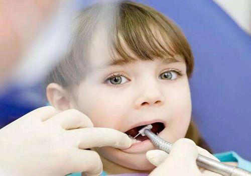 儿童乳牙龋病特点,儿童乳牙易患龋的因素