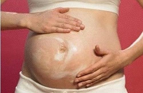 孕妇长湿疹是什么原因 怀孕长湿疹是什么原因引起的