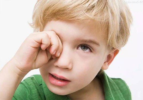 干眼症缺什么维生素 干眼症是缺哪种维生素