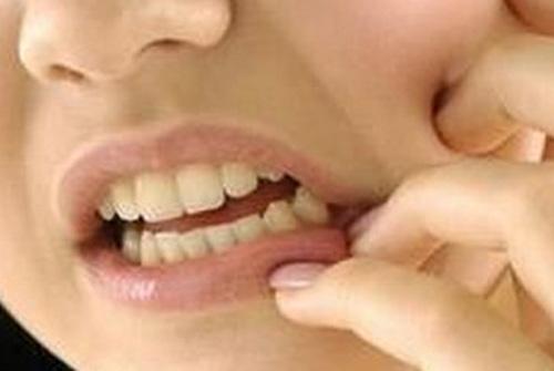 智齿牙龈肿痛可以吃阿莫西林吗 智齿导致牙龈肿痛可以吃阿莫西林吗