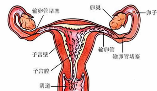 输卵管堵塞的表现（输卵管堵塞的表现有哪些）