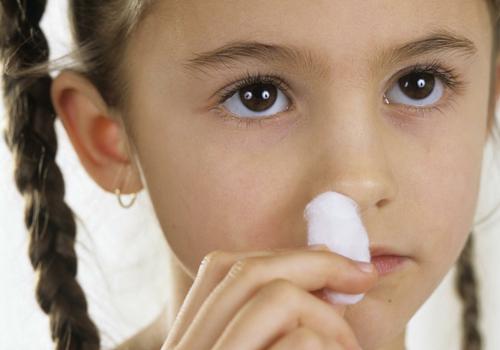 经常流鼻血是白血病吗（12岁小孩经常流鼻血是白血病吗）