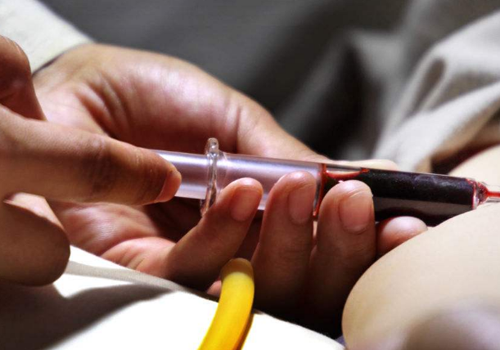 荨麻疹检查需要抽血吗 荨麻疹是要抽血才能查出来吗