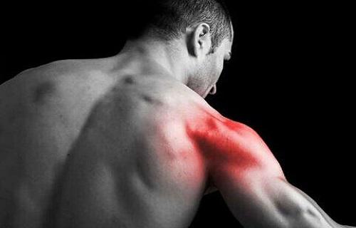 肌肉酸痛和肌肉拉伤区别 肌肉拉伤和肌肉酸痛怎么区分