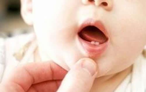 宝宝缺钙会有什么影响 宝宝缺钙的话会有什么影响