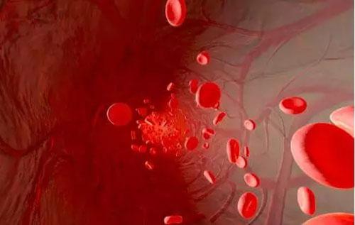 怎么保护血管健康 如何在日常生活中保护血管的健康