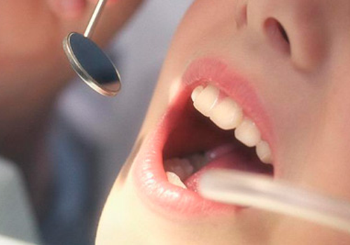 蛀牙是什么原因导致的 蛀牙是啥原因