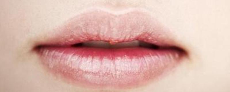 嘴唇发干是缺乏哪种维生素 嘴唇干燥是缺乏哪种维生素