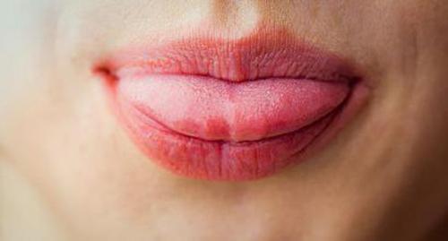舌头红是什么原因 男人舌头红是什么原因