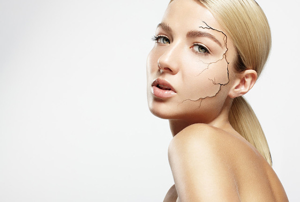如何改善皮肤干燥症 怎么改善皮肤干燥