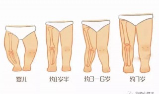 学生0型腿怎么矫正 如何改善o型腿 中学生