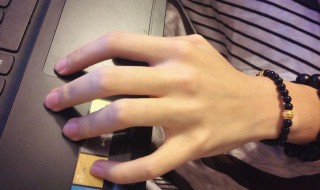 手腕手指有痣代表什么 手腕手指有痣代表什么女