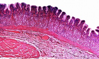 小肠粘膜上皮细胞吸收葡萄糖属于什么转运形式 小肠粘膜细胞吸收葡萄糖是主动运输吗