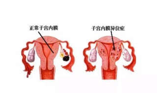 宫颈在哪个位置 上药到宫颈在哪个位置