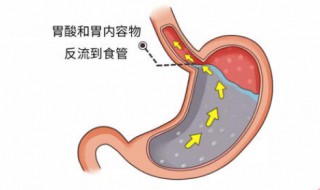 怎样养胃护胃（怎样养胃护胃好）