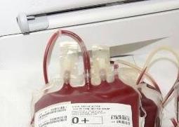 献血的好处和坏处都有哪些（献血有什么坏处和好处）