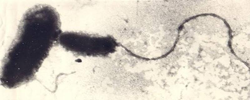 蛭弧菌在水产为何禁用 蛭弧菌禁用的原因