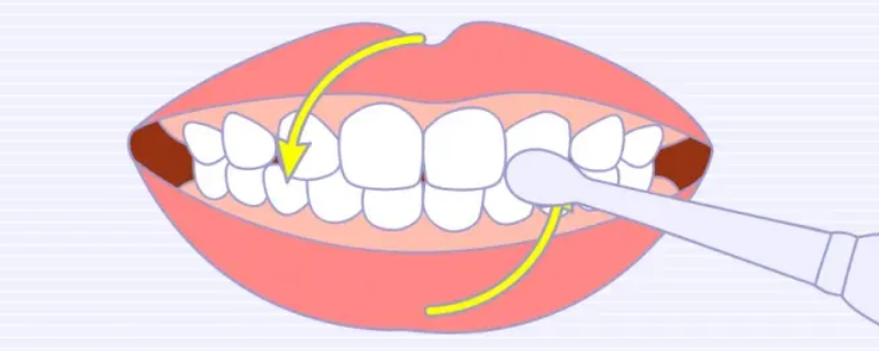 圆弧刷牙法（圆弧刷牙法视频教程）