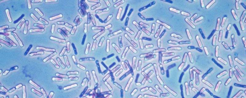 乳酸菌是细菌吗 酵母菌和乳酸菌是细菌吗