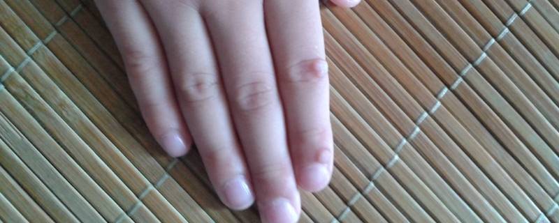 拇指是哪个手指 右手拇指是哪个手指