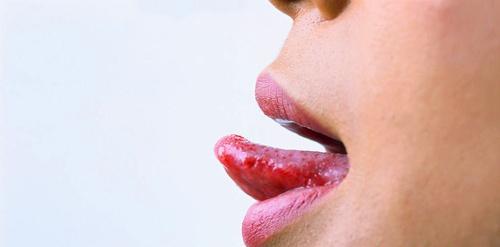 舌癌的早期症状 舌癌的早期症状有哪些