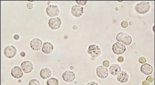 白细胞偏低的原因 血红细胞和白细胞偏低的原因