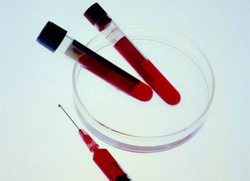 血浆的作用 血浆的作用与功能