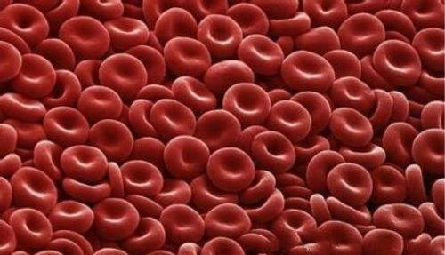 红细胞压积 红细胞压积偏高是什么意思