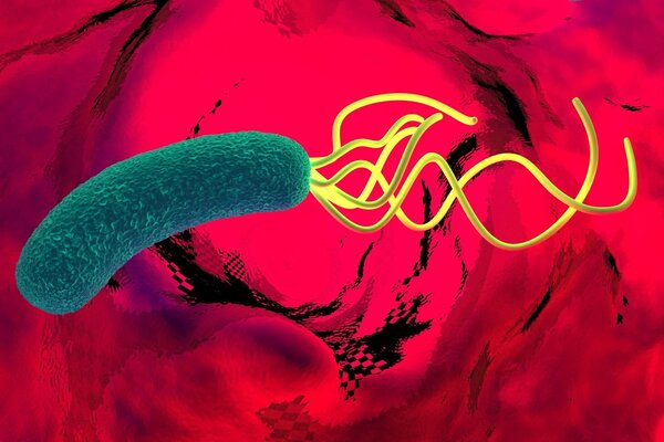 幽门螺旋杆菌又上热搜！如何避免感染，你需要知道这些！