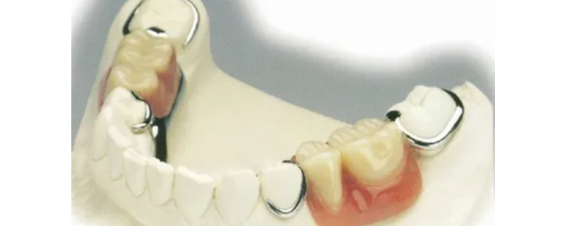 活动假牙咀嚼力能恢复多少（矫正牙齿大概多久恢复咀嚼功能）