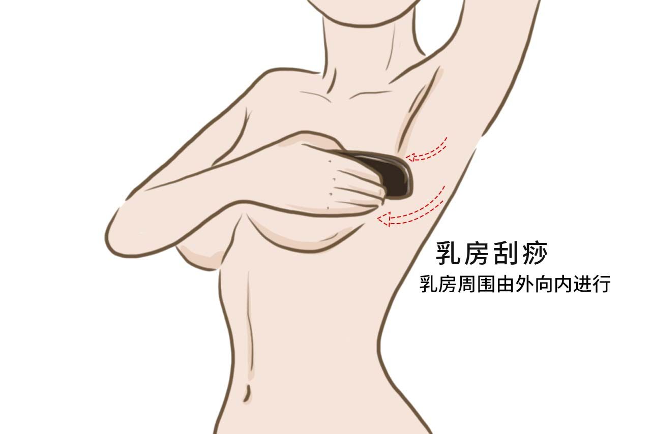 乳房刮痧图解 乳房刮痧图解女性